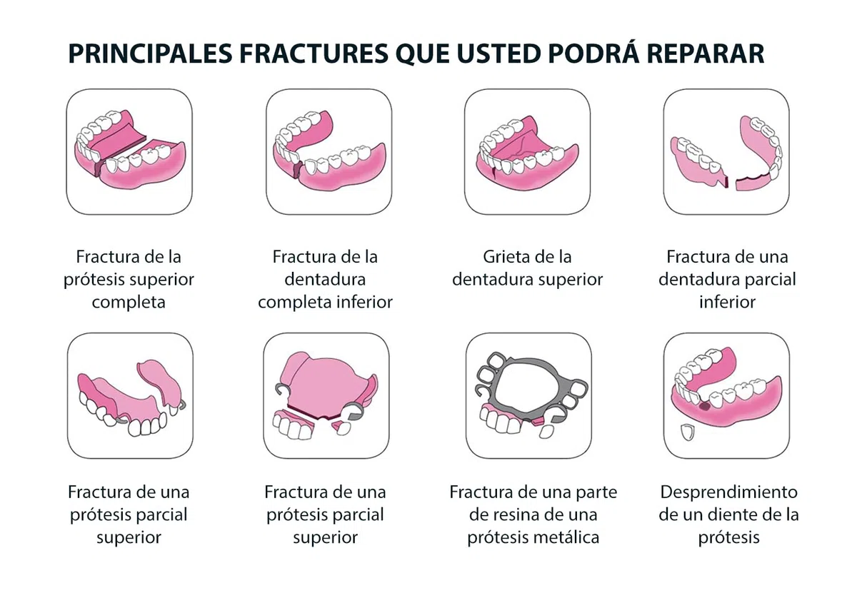 CLICADENT REPAIR- Kit de reparacion para una dentura postiza o un diente suelto