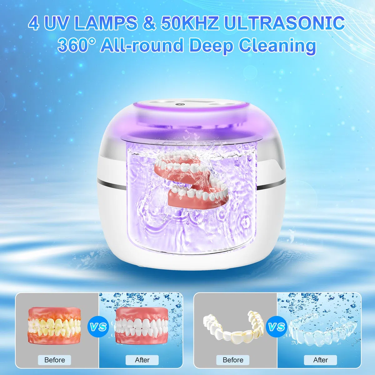 Limpiador Ultrasonidos Dental 50000Hz Ultrasonidos Limpieza con Lámpara UV y 4 Modos, 250ml Ultrasonic Retainer Cleaner Dental Pod para Dentaduras Postizas, Retenedores, Joyas, Blanco