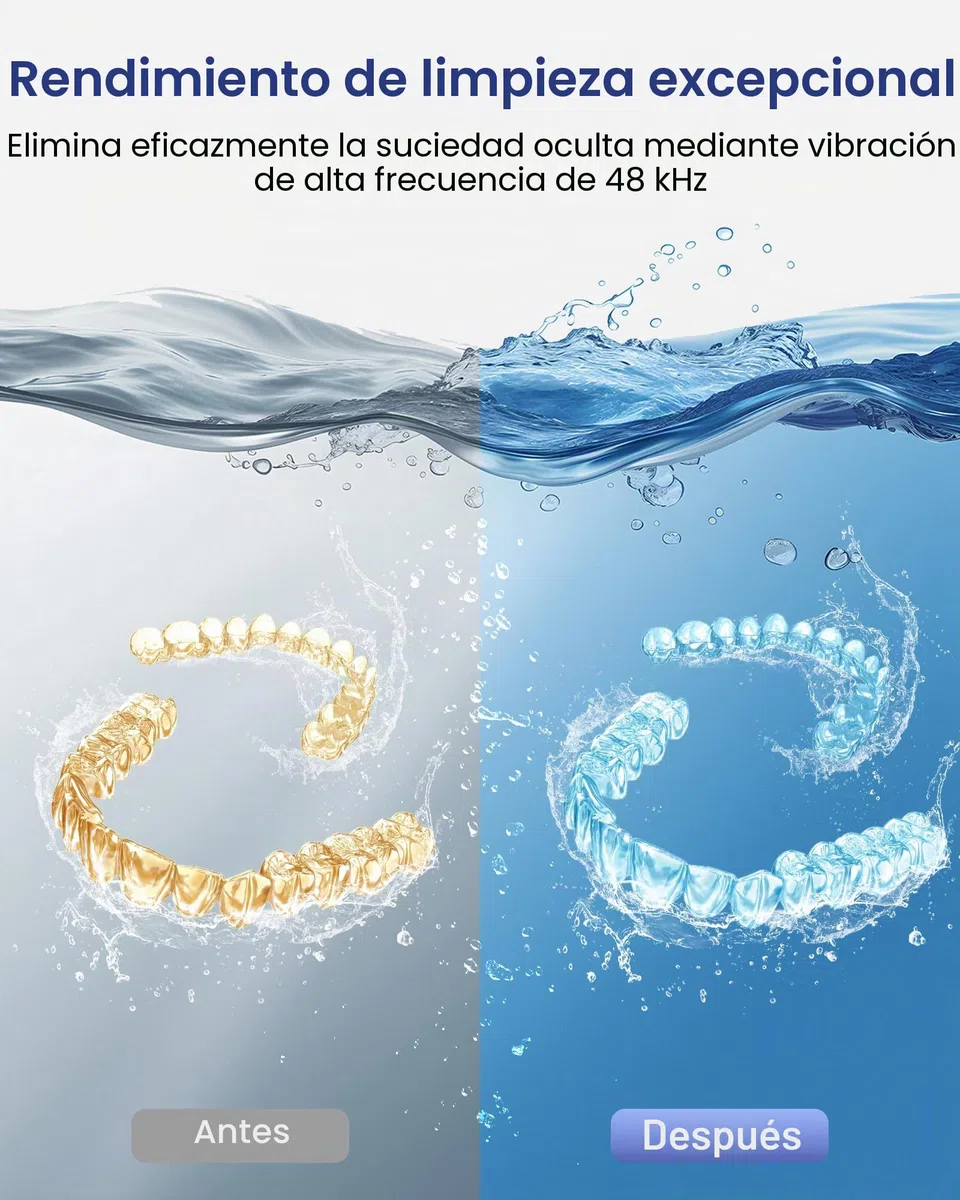 Limpiador Ultrasónico, 48000Hz Limpieza Dental Ultrasonidos, 375ML con 4 Lámparas UV Automáticas, para Ultrasonidos Limpieza Dental de Dentaduras, Retenedores, Alineadores y Joyas