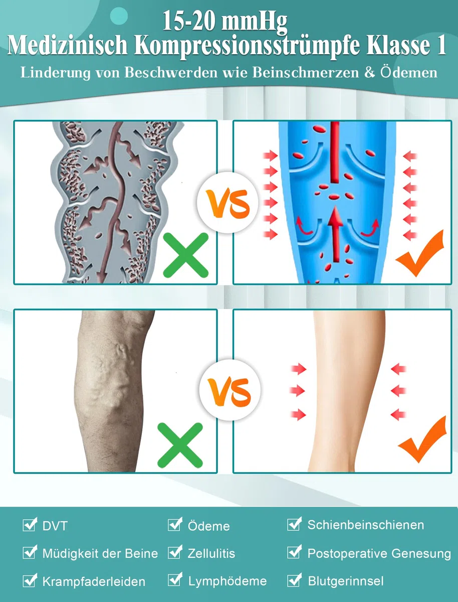 Medias de compresión médicas largas para mujer y hombre, clase 1, 15 – 20 mmHg, calcetines de trombosis para mujer, calcetines de compresión de vuelo, 2 pares de medias de apoyo para varices