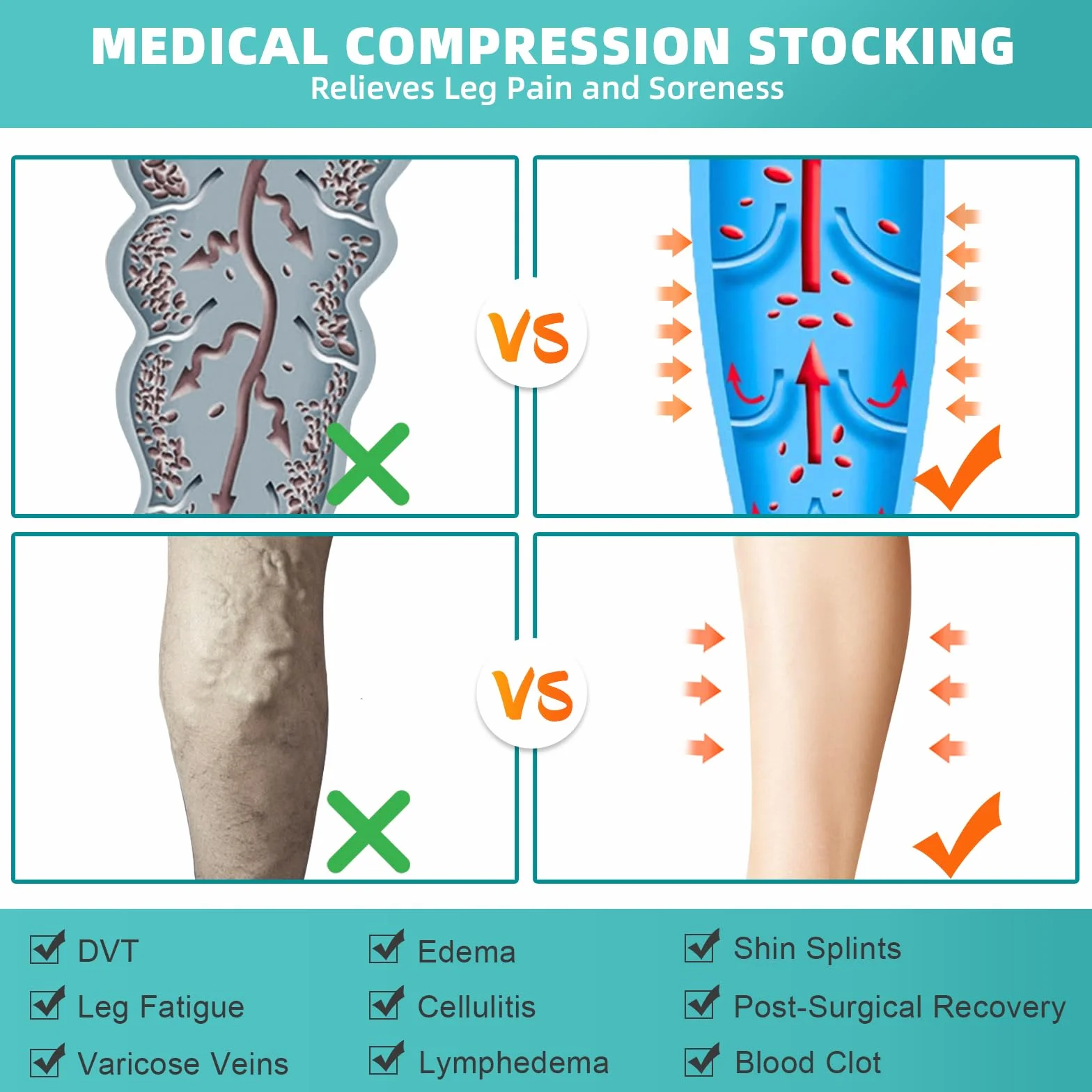 2 pares de medias de compresión médicas para hombre y mujer, 20 – 30 mmHg, clase II muslo largas medias de compresión para viajes en avión Soporte graduado para venas varicosas